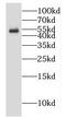 Putative polypeptide N-acetylgalactosaminyltransferase-like protein 5 antibody, FNab03328, FineTest, Western Blot image 