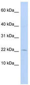 FKBP Prolyl Isomerase 2 antibody, TA344329, Origene, Western Blot image 