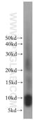 Tumor Suppressor 2, Mitochondrial Calcium Regulator antibody, 11538-1-AP, Proteintech Group, Western Blot image 