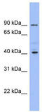 Potassium Voltage-Gated Channel Subfamily J Member 9 antibody, TA338552, Origene, Western Blot image 