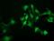 N-Acetylneuraminic Acid Phosphatase antibody, MA5-25923, Invitrogen Antibodies, Immunocytochemistry image 