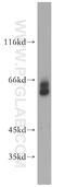 Proactivator polypeptide antibody, 18398-1-AP, Proteintech Group, Western Blot image 