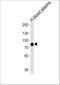 Leucine-rich repeat-containing protein 45 antibody, A16557, Boster Biological Technology, Western Blot image 