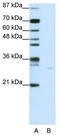 Apoptosis Inducing Factor Mitochondria Associated 1 antibody, TA345681, Origene, Western Blot image 