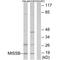 Single Stranded DNA Binding Protein 1 antibody, A05166, Boster Biological Technology, Western Blot image 