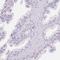 Fatty Acid Binding Protein 5 antibody, HPA051895, Atlas Antibodies, Immunohistochemistry paraffin image 