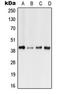 Free fatty acid receptor 3 antibody, LS-C352270, Lifespan Biosciences, Western Blot image 