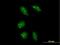 NOP53 Ribosome Biogenesis Factor antibody, H00029997-B01P, Novus Biologicals, Immunocytochemistry image 