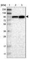 Zinc phosphodiesterase ELAC protein 2 antibody, NBP1-84620, Novus Biologicals, Western Blot image 
