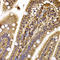 Cytoplasmic Linker Associated Protein 1 antibody, LS-C346219, Lifespan Biosciences, Immunohistochemistry paraffin image 