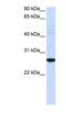 Dorsal Root Ganglia Homeobox antibody, NBP1-91316, Novus Biologicals, Western Blot image 