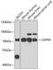 Calpain 5 antibody, GTX33057, GeneTex, Western Blot image 