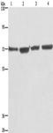 Kruppel Like Factor 11 antibody, TA349371, Origene, Western Blot image 