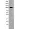 RB Binding Protein 8, Endonuclease antibody, abx218216, Abbexa, Western Blot image 
