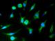 Cell surface glycoprotein MUC18 antibody, 10115-R044-F, Sino Biological, Immunofluorescence image 