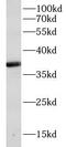 Cathepsin K antibody, FNab01310, FineTest, Western Blot image 