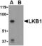 Serine/Threonine Kinase 11 antibody, A00217, Boster Biological Technology, Western Blot image 