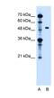 Zinc Finger FYVE-Type Containing 27 antibody, NBP1-59420, Novus Biologicals, Western Blot image 