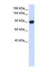 DNA repair and recombination protein RAD54B antibody, NBP1-58233, Novus Biologicals, Western Blot image 