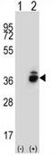 Corticotropin-releasing factor-binding protein antibody, AP51082PU-N, Origene, Western Blot image 
