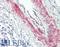 CDC42 Binding Protein Kinase Beta antibody, LS-B8531, Lifespan Biosciences, Immunohistochemistry frozen image 