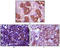 BLK Proto-Oncogene, Src Family Tyrosine Kinase antibody, M01539, Boster Biological Technology, Immunohistochemistry frozen image 