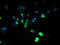 Abhydrolase Domain Containing 2 antibody, A57946-100, Epigentek, Immunofluorescence image 