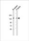 BCL9 Transcription Coactivator antibody, PA5-49466, Invitrogen Antibodies, Western Blot image 