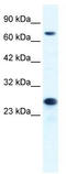DNA replication licensing factor MCM6 antibody, TA341686, Origene, Western Blot image 