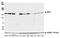 Platelet Derived Growth Factor Receptor Beta antibody, A700-102, Bethyl Labs, Western Blot image 