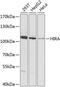 Histone Cell Cycle Regulator antibody, 23-599, ProSci, Western Blot image 
