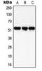 SMAD Family Member 3 antibody, orb214215, Biorbyt, Western Blot image 