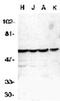 Caspase 10 antibody, ADI-AAP-110-E, Enzo Life Sciences, Western Blot image 