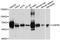 Inactive ubiquitin-specific peptidase 39 antibody, A9582, ABclonal Technology, Western Blot image 