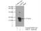 Ubiquitin-conjugating enzyme E2 C antibody, 12134-2-AP, Proteintech Group, Immunoprecipitation image 