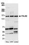 Partner And Localizer Of BRCA2 antibody, A301-246A, Bethyl Labs, Western Blot image 