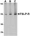 Cytokine receptor-like factor 2 antibody, TA306426, Origene, Western Blot image 