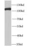 Minichromosome Maintenance Complex Component 3 antibody, FNab05058, FineTest, Western Blot image 