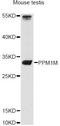 Protein Phosphatase, Mg2+/Mn2+ Dependent 1M antibody, LS-C749449, Lifespan Biosciences, Western Blot image 
