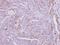 Zinc Finger DHHC-Type Containing 11 antibody, NBP2-15166, Novus Biologicals, Immunohistochemistry paraffin image 