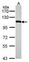 Aminopeptidase Puromycin Sensitive antibody, LS-B10860, Lifespan Biosciences, Western Blot image 