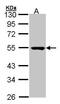 Protein Serine Kinase H1 antibody, PA5-21843, Invitrogen Antibodies, Western Blot image 