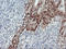 LIM domain kinase 1 antibody, LS-C172997, Lifespan Biosciences, Immunohistochemistry paraffin image 