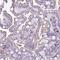 Cathepsin Z antibody, NBP2-38614, Novus Biologicals, Immunohistochemistry paraffin image 