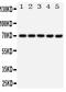 Heat shock 70 kDa protein 1A/1B antibody, PA1813, Boster Biological Technology, Western Blot image 