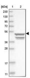 Keratin 20 antibody, NBP1-85598, Novus Biologicals, Western Blot image 