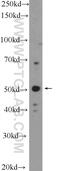 Tryptophan Hydroxylase 1 antibody, 20879-1-AP, Proteintech Group, Western Blot image 