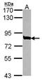 Mediator Complex Subunit 17 antibody, GTX115241, GeneTex, Western Blot image 