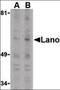 Leucine Rich Repeat Containing 1 antibody, orb86779, Biorbyt, Western Blot image 