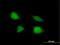 Telomerase RNA Component Interacting RNase antibody, H00079002-B01P, Novus Biologicals, Immunocytochemistry image 